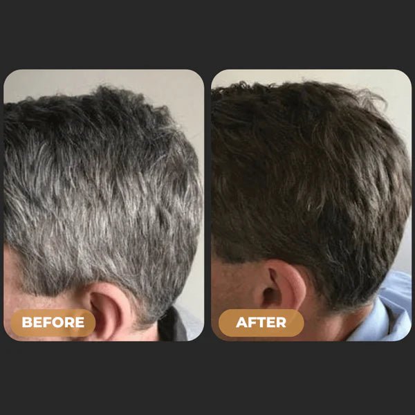 Glamvora™ Gray Hair Reversal Bar